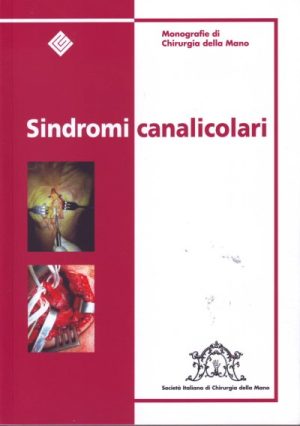 Sindromi canalicolari